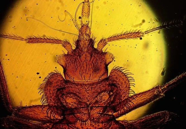 How to Tell If You Have Bed Bugs - Microscope